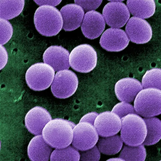 Staphylococcus Food Poisoning